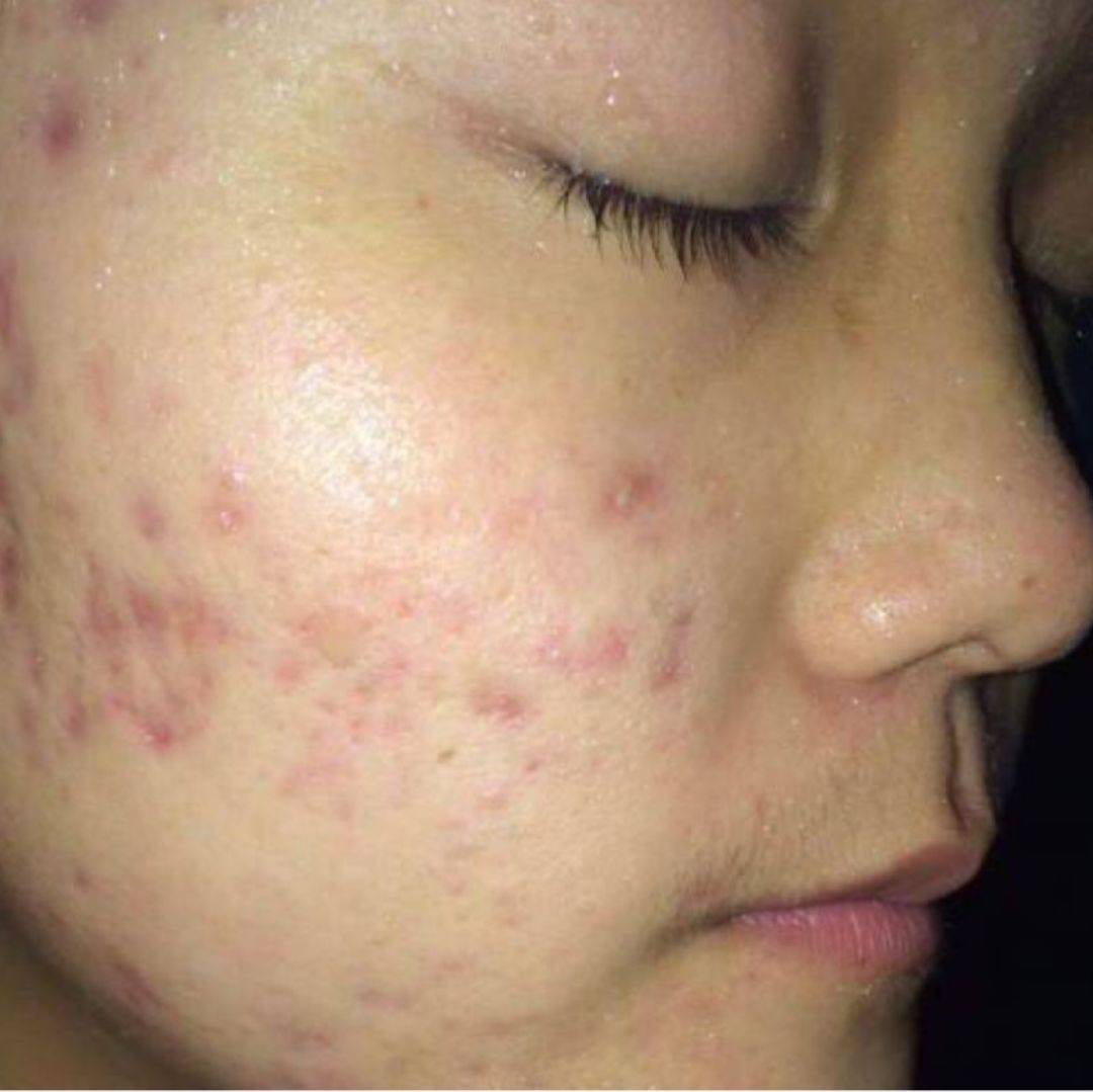 30岁运营总监的抗衰顿悟：线粒体护盾才是科学抗衰的终点站