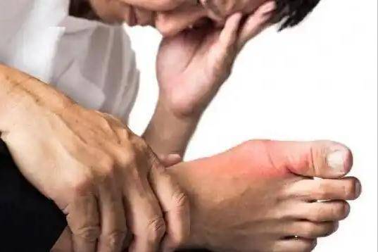 医生：夏天炎热，痛风患者不能做3件事，做的越多，尿酸越难稳定