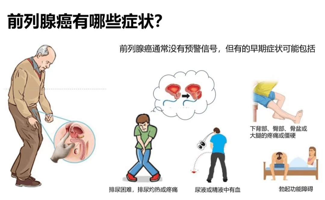 老年男性高发，出现这些信号要警惕！