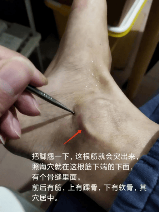 这些穴位就是长在人身上的药！三伏灸一灸，治好你身上一半毛病！