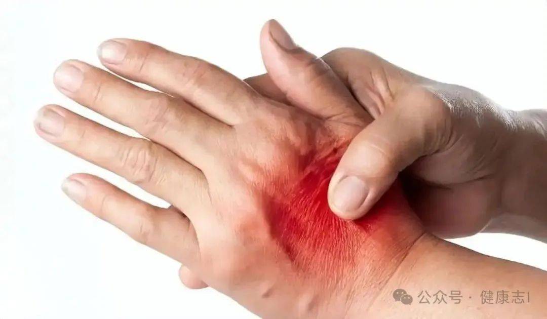 血瘀是大病的导火索？血瘀常有的这7种表现，看看你有没有？