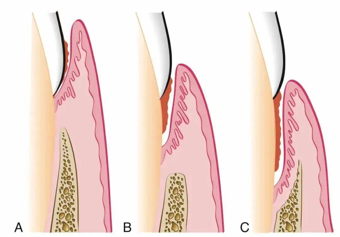 这份护牙全攻略请收好！
