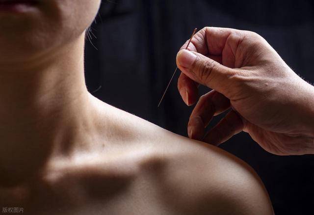 针灸减肥真能躺瘦？揭秘背后的原理与风险