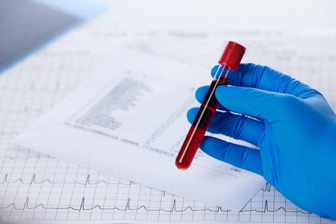 看懂血常规：关注变化，理性应对