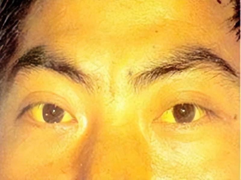 当身体发出这些信号，养肝刻不容缓！