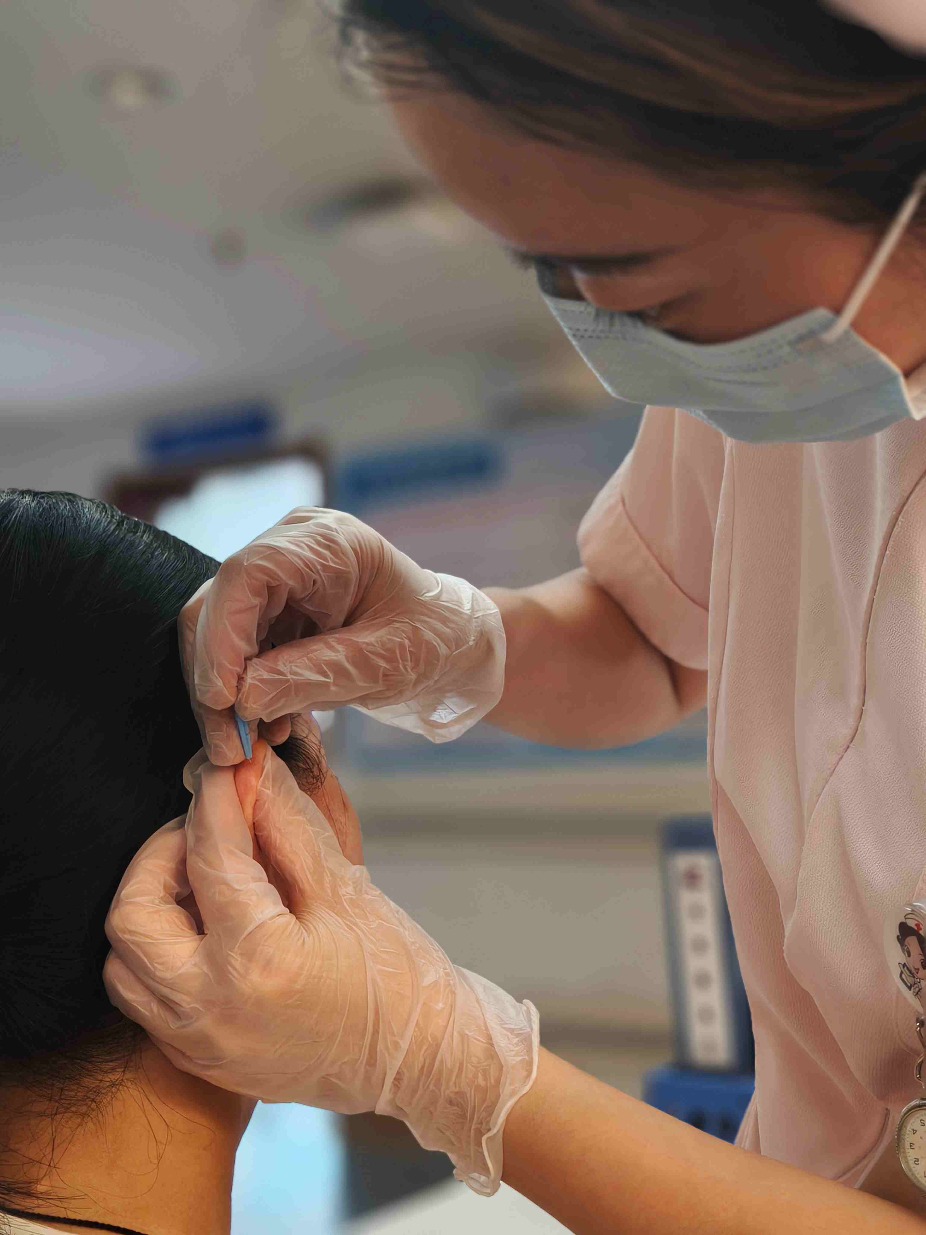 中医治疗显妙招，放血疗法解病痛