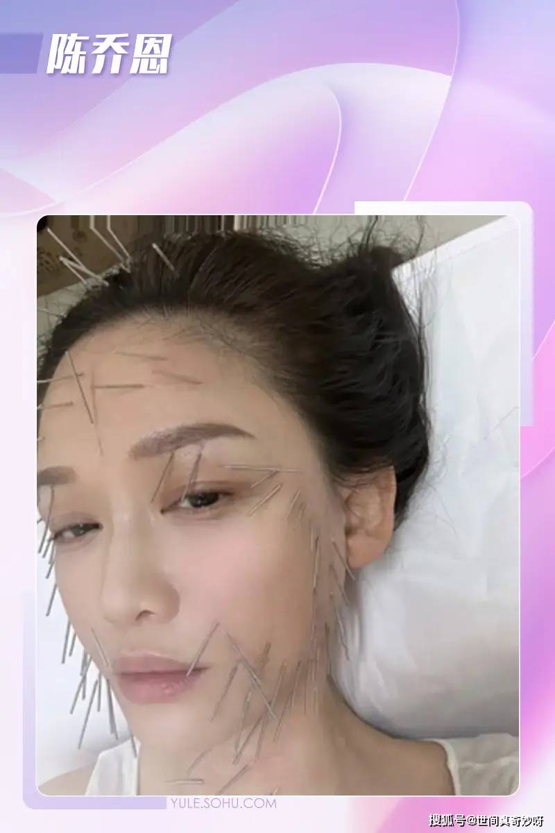 原创            陈乔恩为美容满脸扎针、宋慧乔钟爱鸟粪面膜，她们为美也太拼命了！