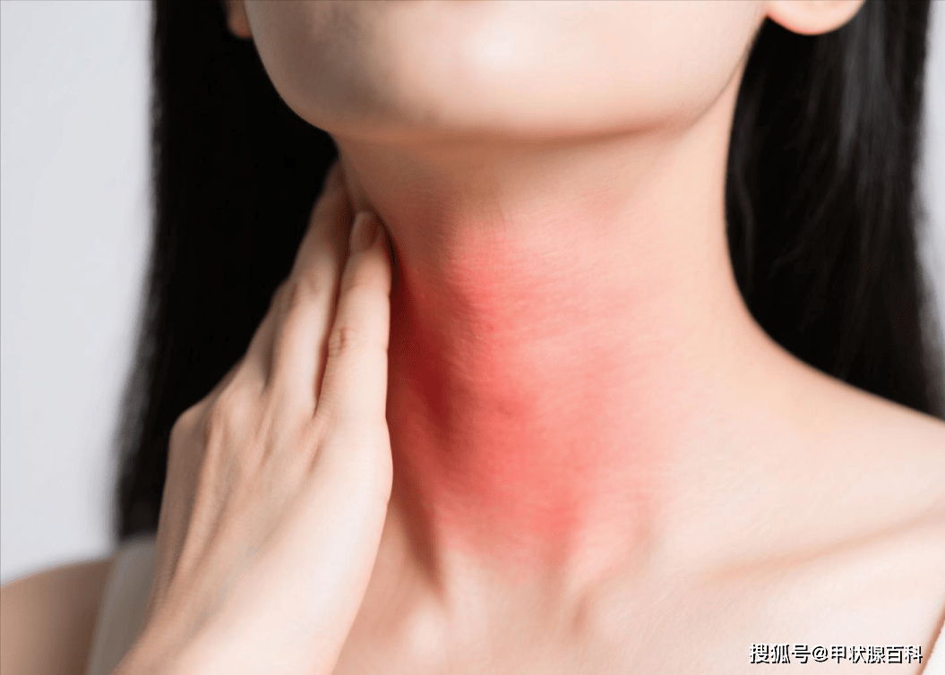 南昌市第五医院甲状腺科：甲状腺不好，往往会有5个症状！