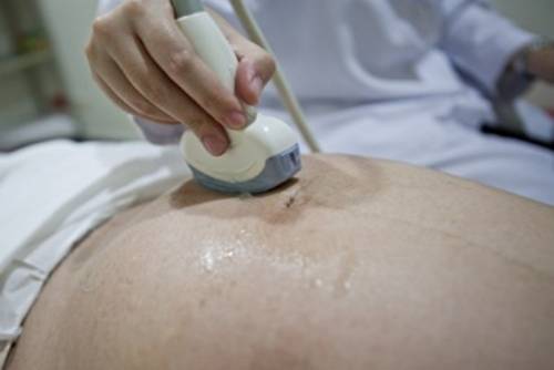 腔道用耦合剂残留伪影处理方法—平创医疗