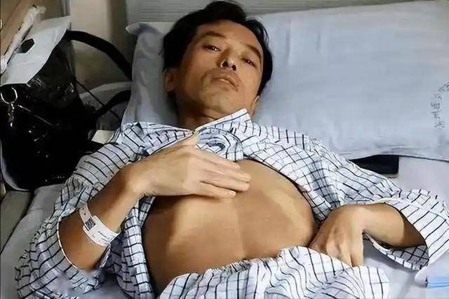 57岁男子肝硬化去世，医生警告：把3样当零食吃，肝脏好也扛不住