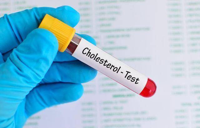 胆固醇代谢与早餐有关？建议：胆固醇高，早餐注意2细节，别忽视