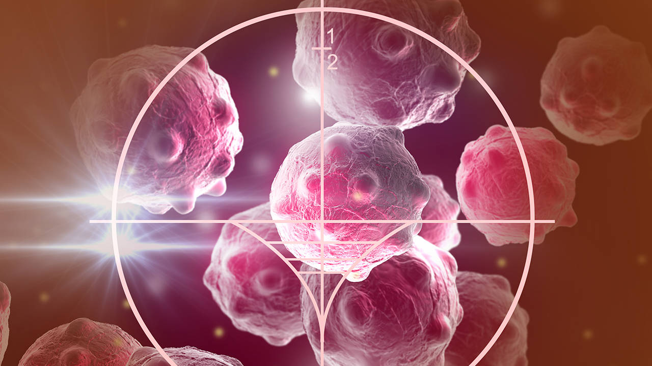 转移肝癌复查时，应该关注哪些方面？