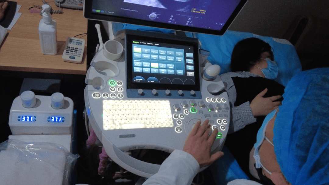 天津大排畸是四维彩超 那小排畸是什么