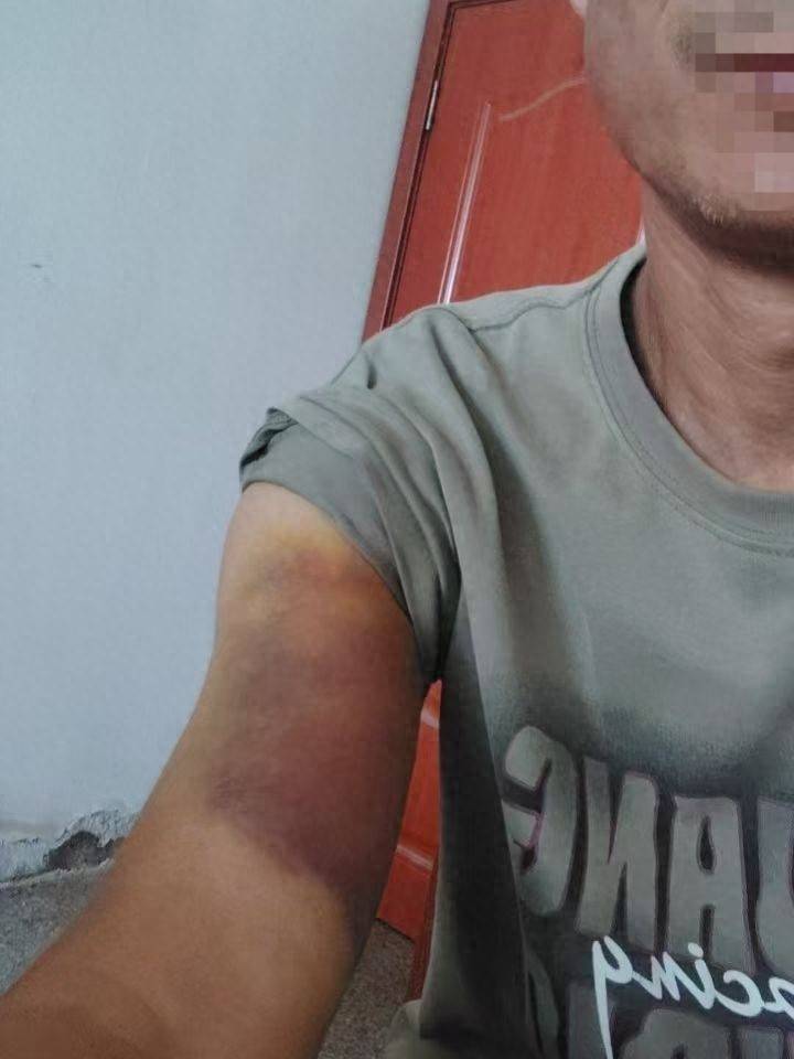 河南一男子称因发视频反映村干部家占道遭殴打 多方回应