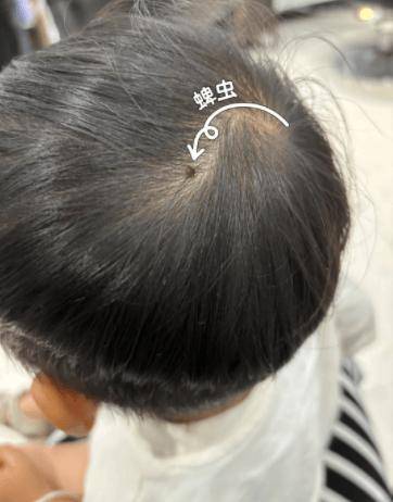 危险！身上忽然冒出这种小黑点，警惕是“夺命蜱”