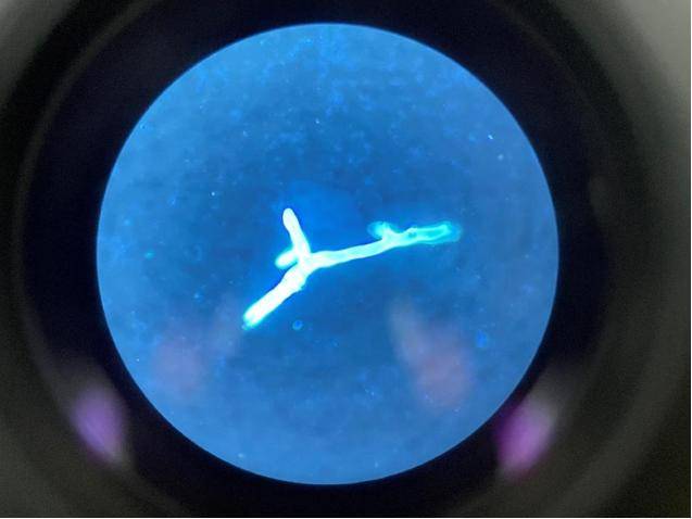 鼻腔剧痛、肺部“长毛”……这种真菌长到身上后果很严重！