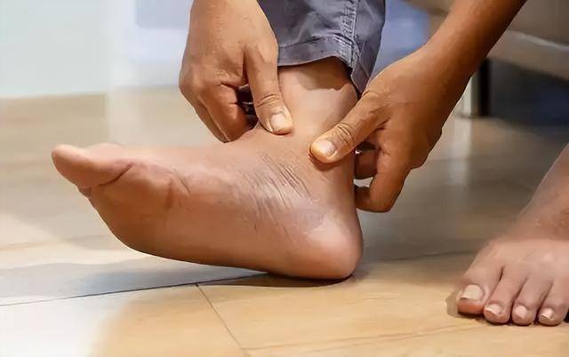 高温天气，医生叮嘱痛风患者：宁可多看会手机，也不要频繁做3事