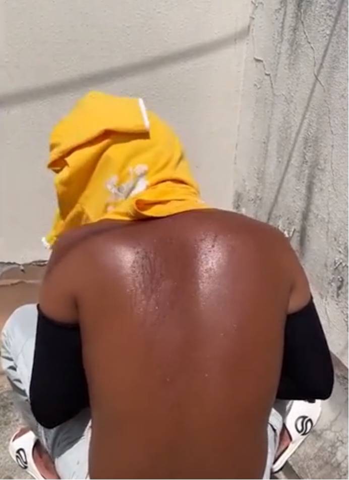 原创            广东小伙三伏天接受暴晒，只为尽快祛湿，网友：这后背太亮了