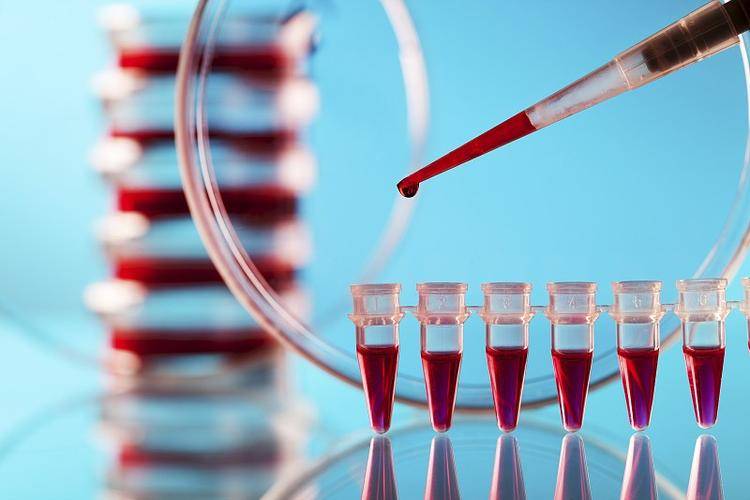 怎样寄血去香港验性别?一般不建议