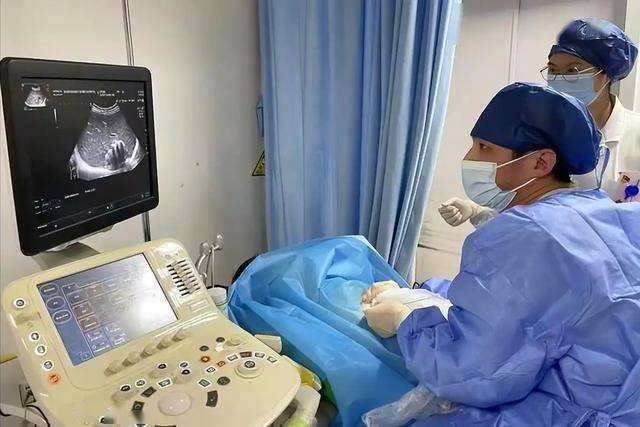 医生研究发现：肝脏有问题的人，身体通常会表现出这4个特征