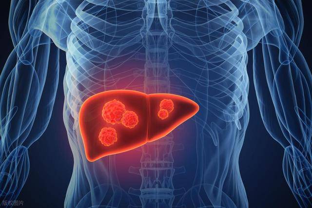 肝脏排毒时刻表：深夜你的肝在偷偷“加班清垃圾”