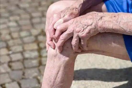 双腿是高血压“放大镜”？医生：双腿出现这4个异常，小心并发症