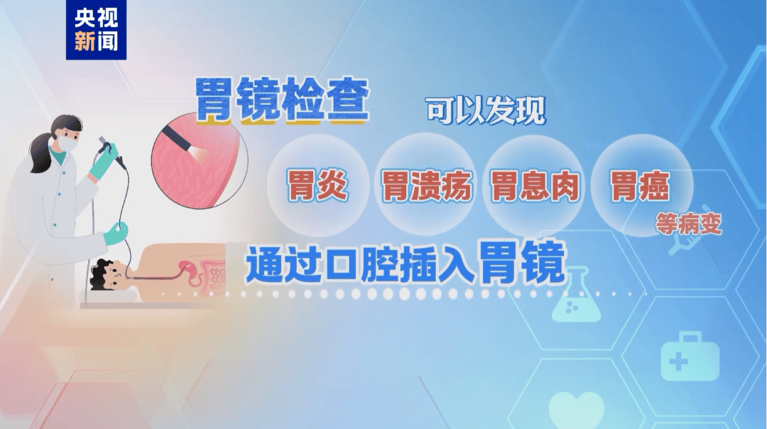 位列癌症发病率前五，七成患者确诊时已为中晚期，这个检查很有必要