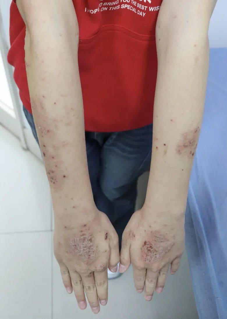 集中爆发！这类人一到黄梅天就遭殃：晚上根本睡不着！10条实用建议