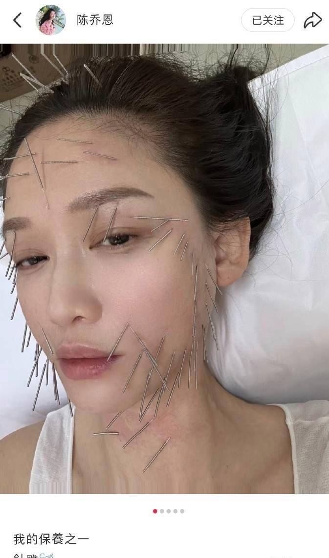 原创            陈乔恩做“针雕”吓坏网友，全身插上千支钢针，连脚趾也没放过