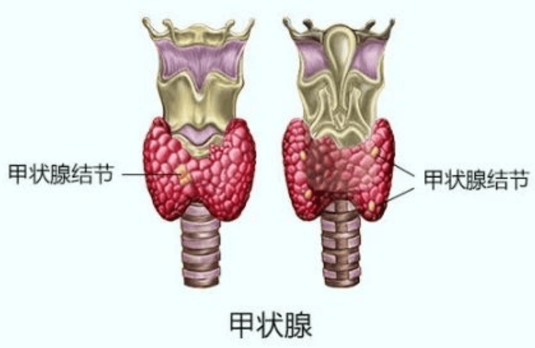 拒绝甲状腺隐患！北京甲状腺专家武春青教授带你解锁健康密码