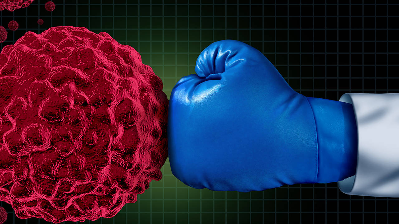 大细胞肺癌化疗预后怎么样？预后如何？