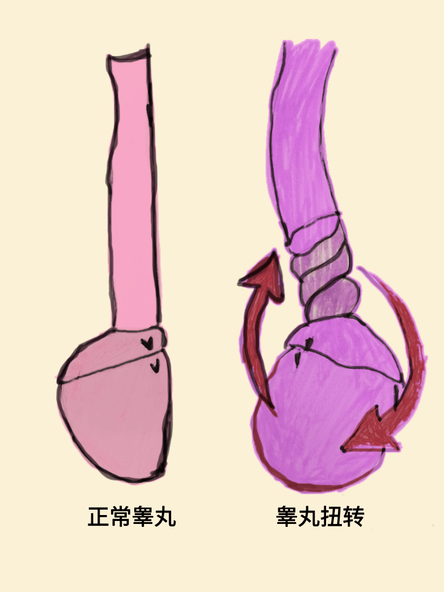 萧山17岁男生睡醒后，这里剧痛！差点永远失去……