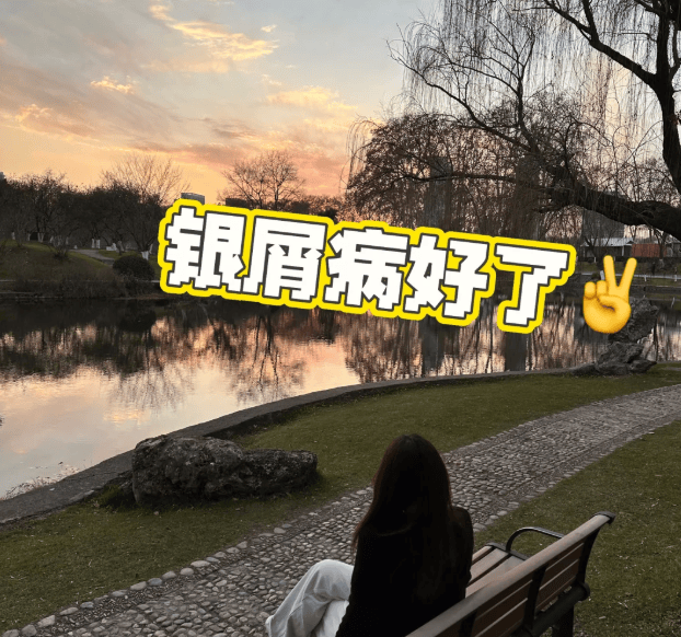 银屑病「上岸」攻略！从斑块到光滑，这些方法我锁死了！