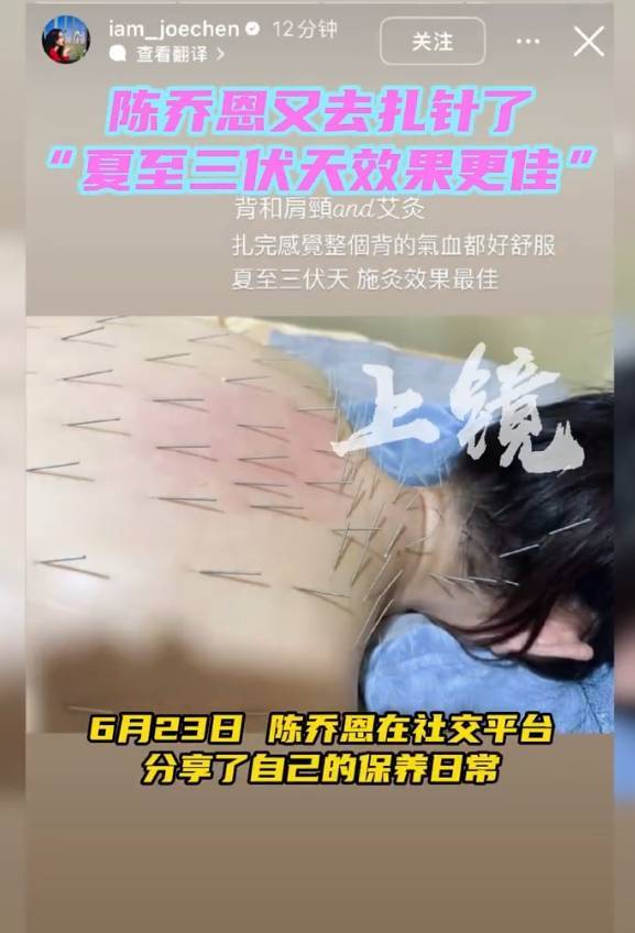 陈乔恩晒保养日常又去扎针了：夏至三伏天，施灸效果更佳