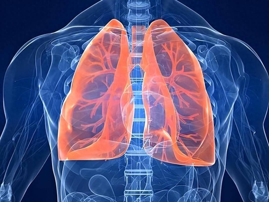 原创            体检发现肺结节？别慌！医生提示：90%是良性，但这些人必须警惕