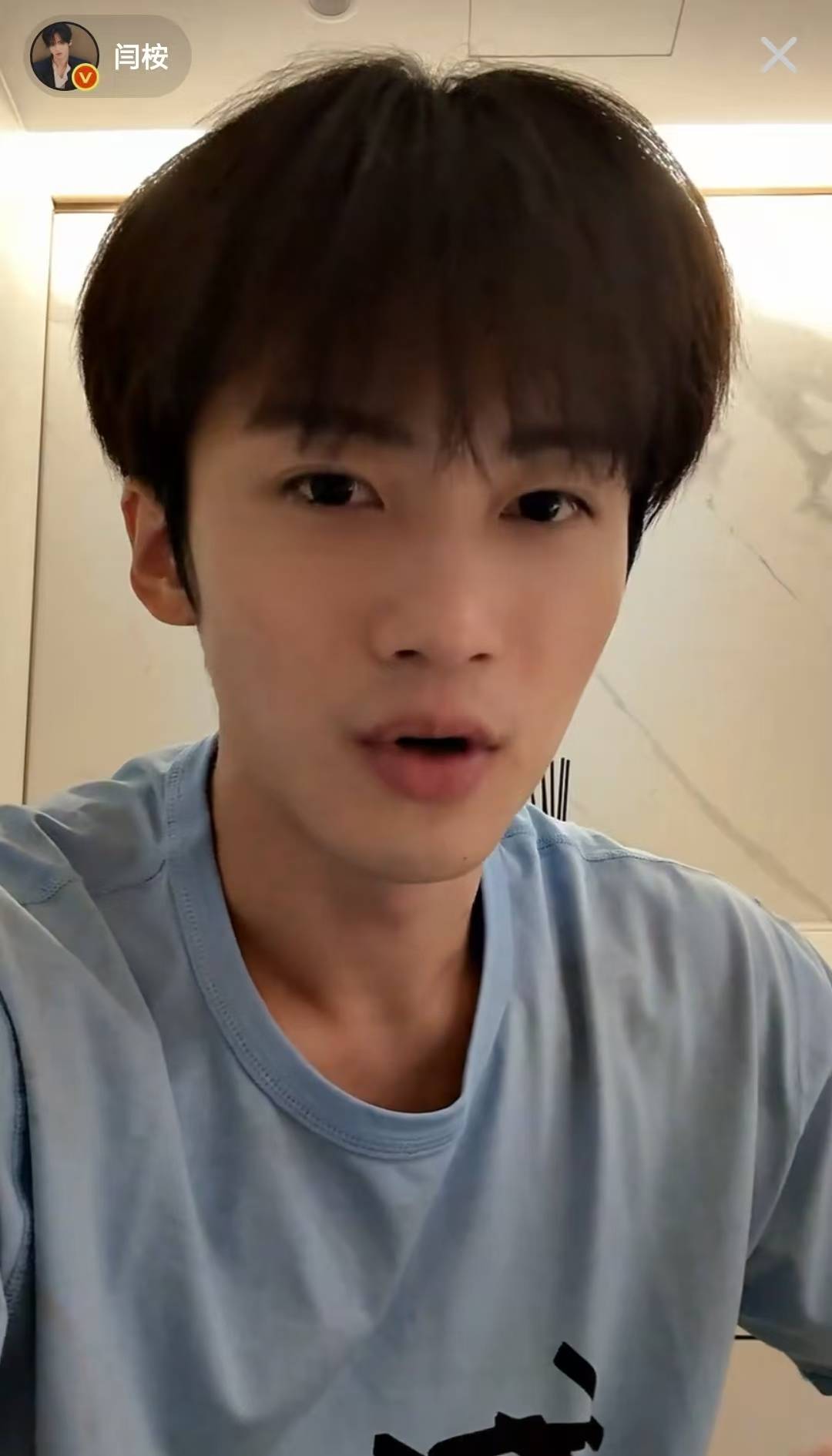 《大梦归离》男演员自曝：头上长了一个东西，要做小手术