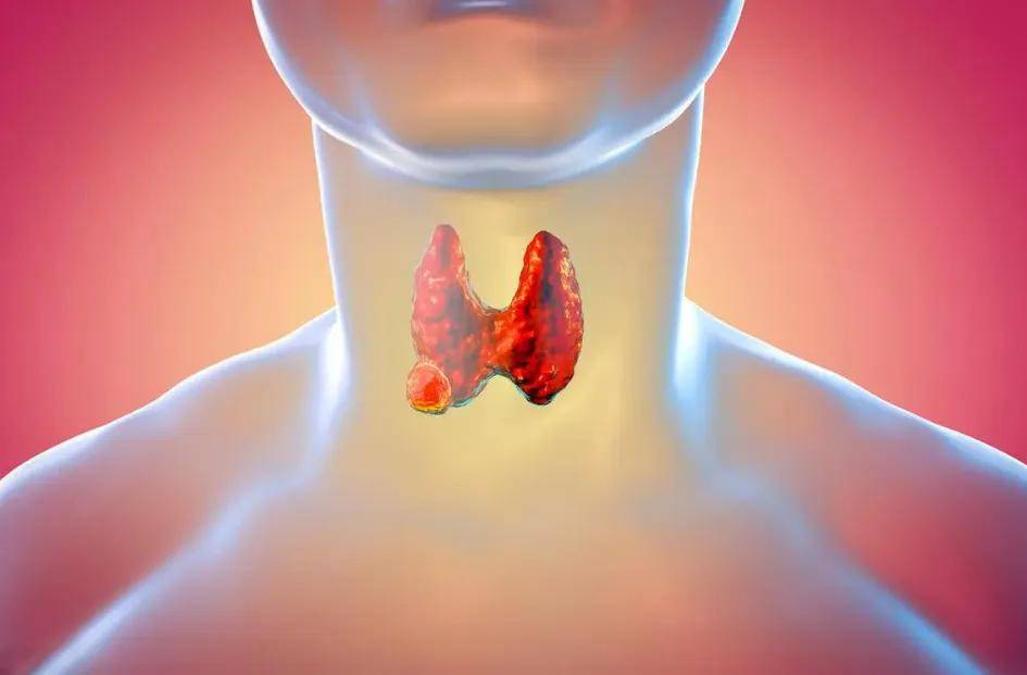 结节大小≠危险程度！医生揭秘真正该关注的指标是什么