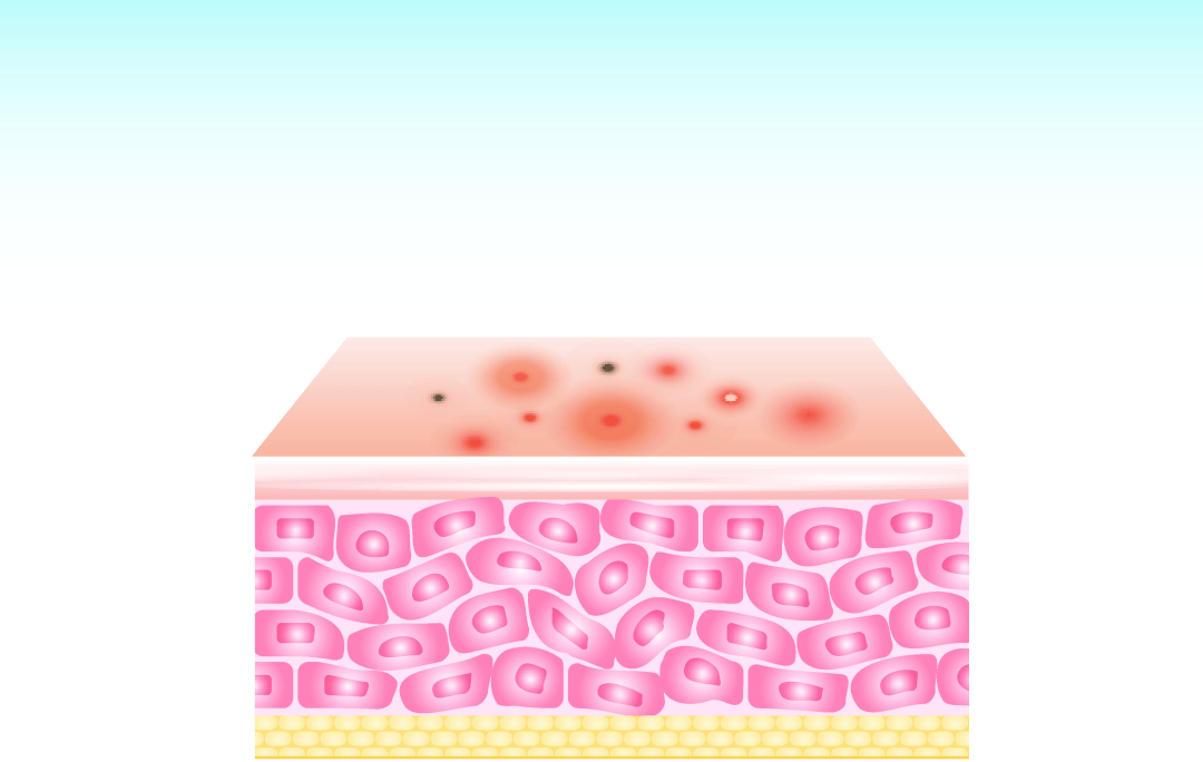 昆明良方外阴白斑研究中心所有医生-外阴白斑疾病有哪些危害，严重吗？
