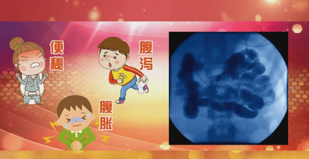 喝多少酸奶，都不如这公认的“肠道保护伞”！每天吃点，护肠道强体质，一身轻松！