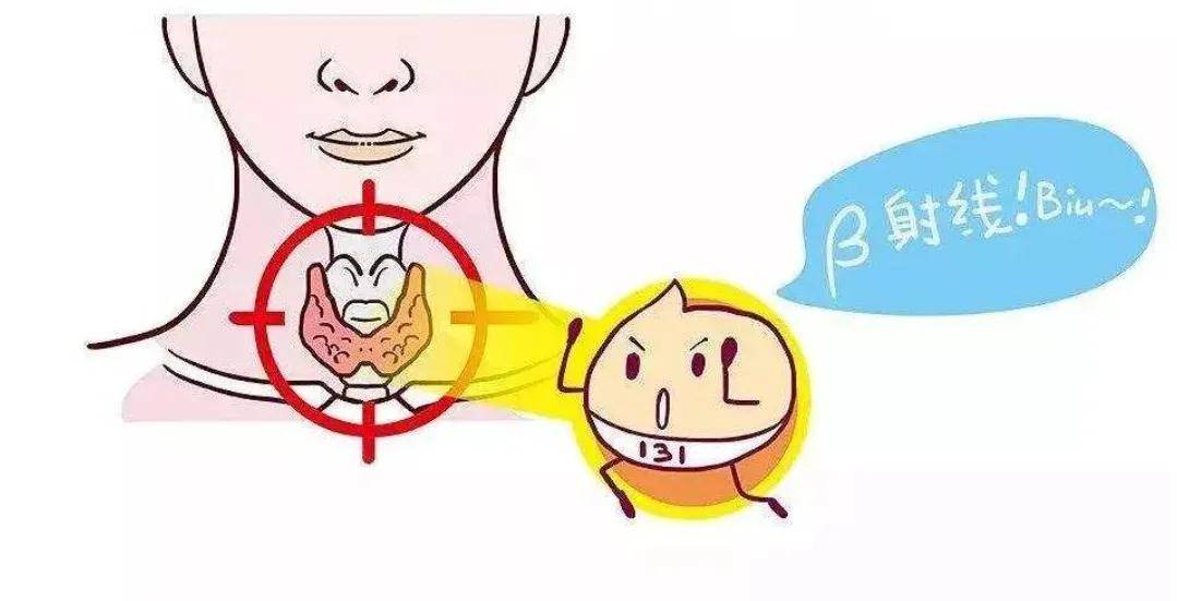 甲状腺癌碘131治疗的认识误区！