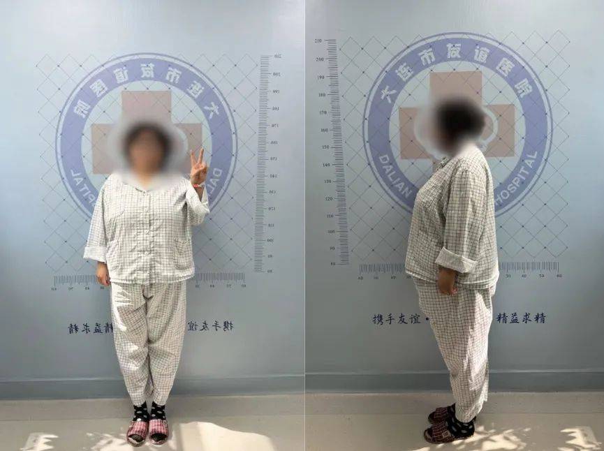 【友谊胃肠外科】曾经胖到抑郁，科学减重助她重拾生活掌控感