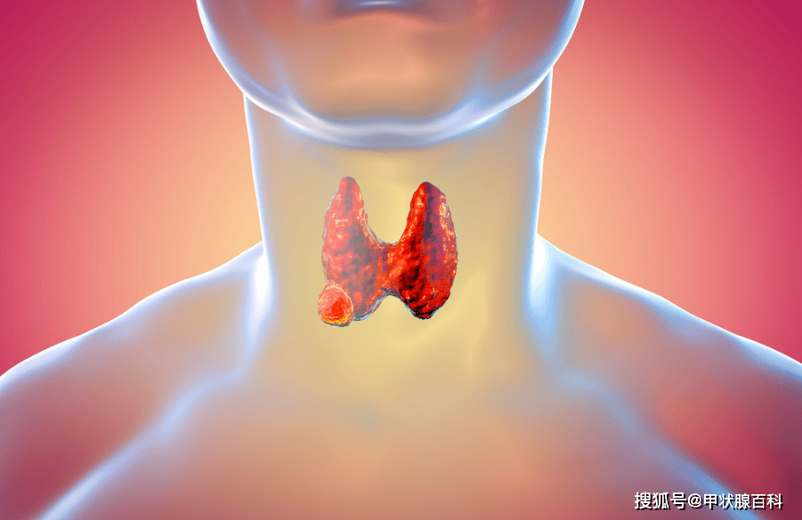 南昌第五医院甲状腺科江辉主任：高温来袭后！甲状腺患者警惕