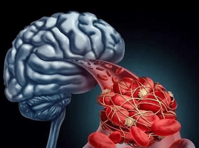 原创            多吃4种菜, 改善脑供血