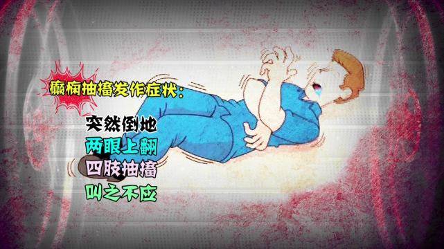 兰大二院难治性癫痫手术治疗多学科会诊