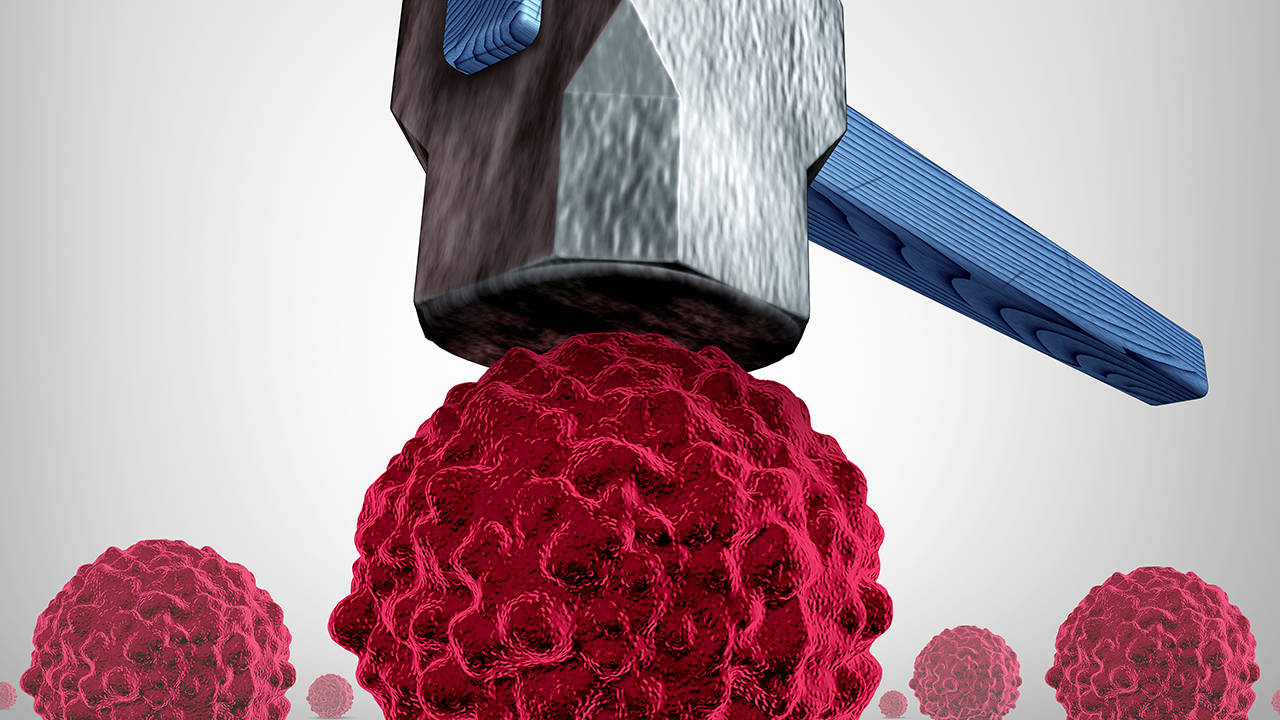 胰腺癌没化疗能活久？生存时间？