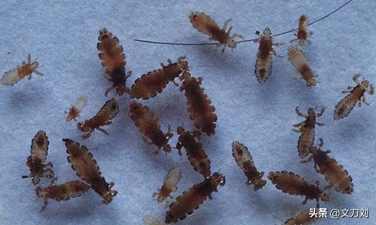 原创            七八十年代以前虱子很疯狂，现代人咋不长虱子了？