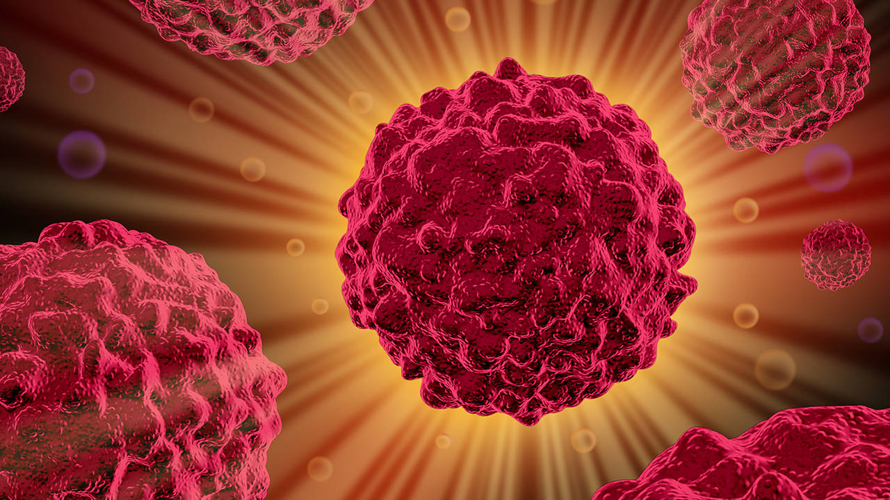 胆囊癌多处转移骨转移多处？还能治吗？