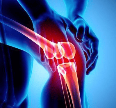 对付滑膜炎的有效的方法终于找到了！现在恢复的差不多了