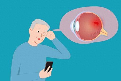 原创            干眼症只是眼睛缺水这么简单?大错特错! 盲目滴眼药水危害不小