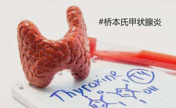 桥本氏甲状腺炎，精准定位+修复治疗，北京北苑中医院新突破